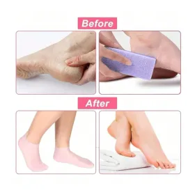 Set De Chaussettes De Soins Des Pieds En Silicone