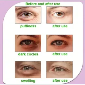 Masques Froid en gel pour les yeux