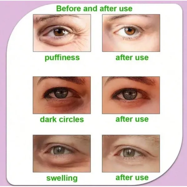 Masques  Froid  en gel pour les yeux