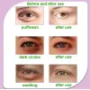 Masques  Froid  en gel pour les yeux