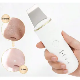 Appareil de nettoyage cutané à ultrasons pour le visage