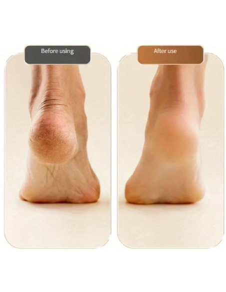 Râpe électrique rechargeable pour pieds — 2 têtes